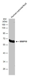 Anti-MMP19 antibody used in Western Blot (WB). GTX108931